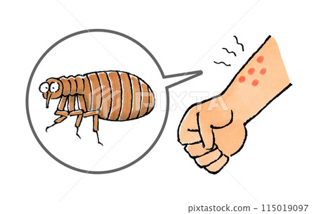 Flea bitten arm Flea bitten arm 115019097