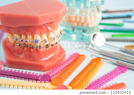 Orthodontic ligatures rings and ties, elastic rubber bands on orthodontic braces, model for dentist studying about dentistry. 115032413