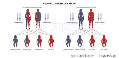 Cerebellar ataxia pattern 115039950