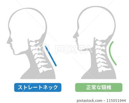 2024-Straight neck illustration 115051944
