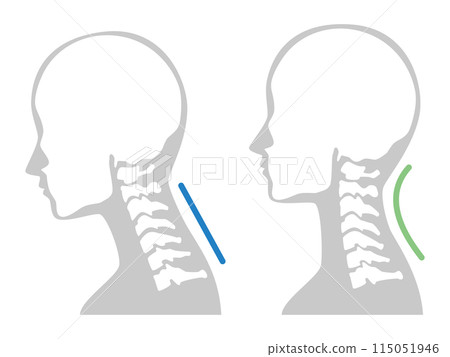 2024-Straight neck illustration 2024-Straight neck illustration 115051946