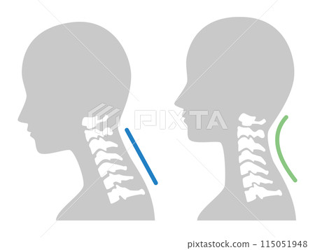 2024-Straight neck illustration 115051948