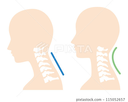 2024-Straight neck illustration 2024-Straight neck illustration 115052657