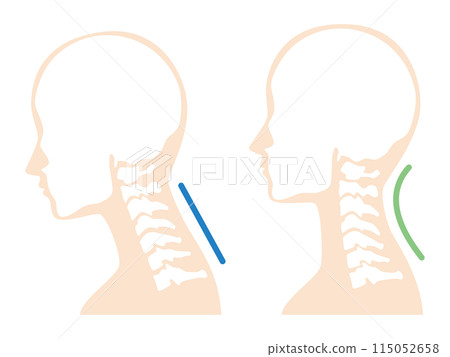 2024-Straight neck illustration 2024-Straight neck illustration 115052658
