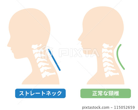 2024-Straight neck illustration 115052659