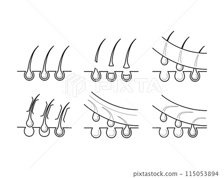 Icons of hair removal methods. Icons of hair removal methods. 115053894