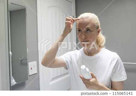 Female Applies Moisturizer, Cream on Sunburn Skin On Scalp, Forehead Under Hair in Bathroom. White Woman Suffers From Sun Burn, Holding White Tube, Bottle of Remedy. Horizontal. UV Danger 115065141