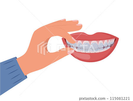 Hand applying clear aligner on teeth. Concepts of dental care and orthodontic dentistry. Teeth straightening with clear aligners. Vector. Hand applying clear aligner on teeth. Concepts of dental care and orthodontic dentistry. Teeth straightening with clear aligners. Vector. 115081221