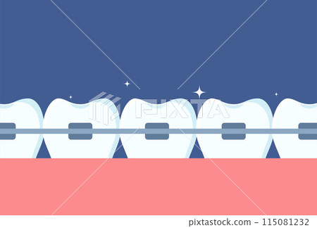 Row of teeth with braces on them. Orthodontics and aesthetic dentistry medicine. Molars with braces. Dentistry, whitening, orthodontics. Vector. Row of teeth with braces on them. Orthodontics and aesthetic dentistry medicine. Molars with braces. Dentistry, whitening, orthodontics. Vector. 115081232