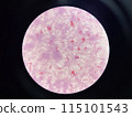 Moderate gram negtive bacilli in hemoculture. 115101543