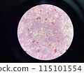 Moderate gram negtive bacilli in hemoculture. 115101554