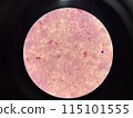Moderate gram negtive bacilli in hemoculture. 115101555