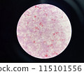 Moderate gram negtive bacilli in hemoculture. 115101556