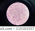 Moderate gram negtive bacilli in hemoculture. 115101557