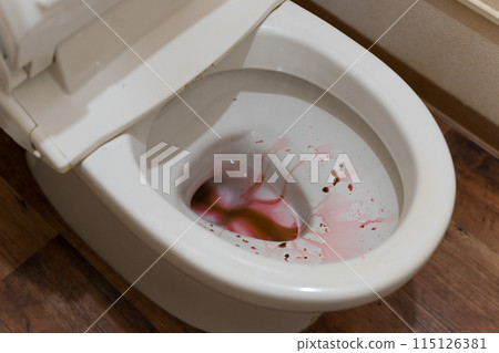 Bloody toilet, blood in urine, menstrual blood 115126381