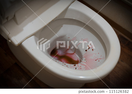 馬桶帶血、血尿、經血 馬桶帶血、血尿、經血 115126382