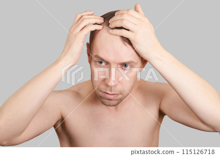 Man baldness treatment. Anti hairloss clinic test. Nature hair care procedure 115126718