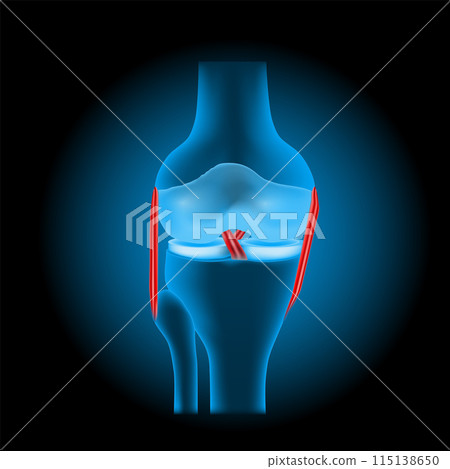 ligament injuries to the knee joint 115138650