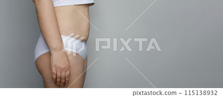 Female belly after pregnancy and childbirth on white background 115138932