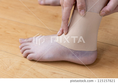 A woman applying a compress to her sprained ankle A woman applying a compress to her sprained ankle 115157821