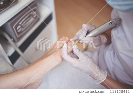 Hardware medical pedicure with nail file drill apparatus. Patient on pedicure treatment with pediatrician chiropodist. Foot peeling treatment at spa with a special device. Clinic of Podiatry Podology 115158411