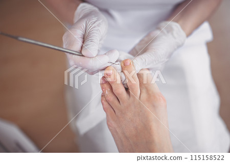 Professional medical pedicure procedure close up using double nail instrument. Patient visiting chiropodist podiatrist. Foot treatment in SPA salon. Podiatry clinic. Pedicurist hands in white gloves. 115158522