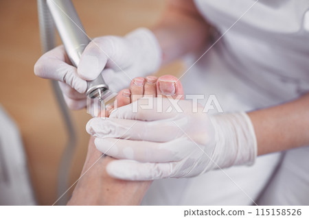 Hardware medical pedicure with nail file drill apparatus. Patient on pedicure treatment with pediatrician chiropodist. Foot peeling treatment at spa with a special device. Clinic of Podiatry Podology 115158526