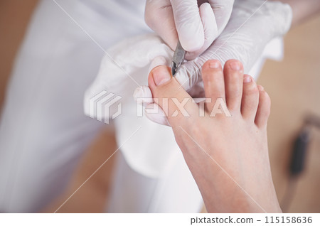 Professional medical pedicure procedure close up using nail clippers instrument. Patient visiting chiropodist podiatrist. Foot treatment in SPA salon. Podiatry clinic. Pedicurist hands white gloves. 115158636