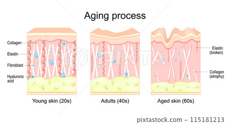 Aging process in the skin 115181213