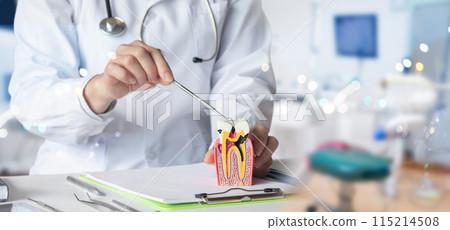 The dentist shows the spread of the disease and pulp formation . The dentist shows the spread of the disease and pulp formation . 115214508