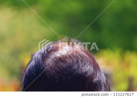 老年女性預防頭髮稀疏的措施 老年女性預防頭髮稀疏的措施 115227627
