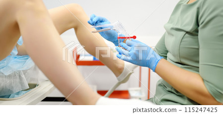 Gynecologist examines a patient laying on gynecological chair using medical vaginal speculum. Doctor takes a smear from a young woman cervix. Diagnosis of diseases. Gynecologist examines a patient laying on gynecological chair using medical vaginal speculum. Doctor takes a smear from a young woman cervix. Diagnosis of diseases. 115247425