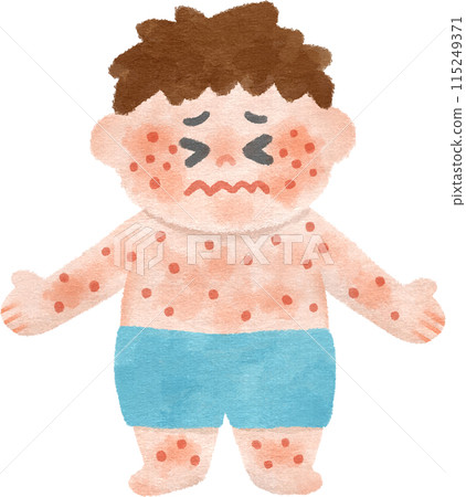 A boy suffering from a rash all over his body Hand-drawn illustration 115249371