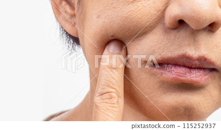 Flabby and wrinkled skin on senior woman face. Flabby and wrinkled skin on senior woman face. 115252937