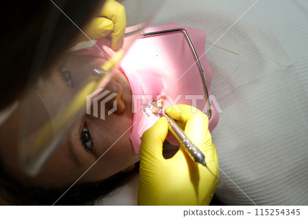 Treatment, cleaning and whitening of a child teeth at a dental clinic.  115254345
