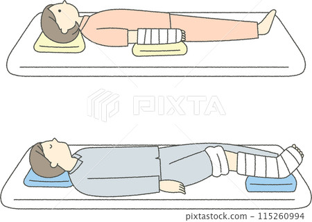 骨折病人躺在床上 115260994