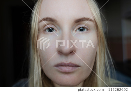 Examination of the fundus and dilated pupils. A doctor performs an ophthalmoscopy on a woman who has mydriasis and accommodation spasm. Poor vision and paralysis of the eye muscles 115262692