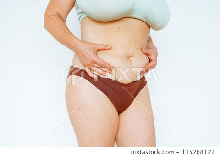 woman in bikini showing fat belly, saggy skin, excess weight 115268172