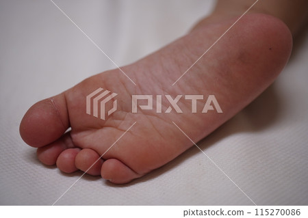 足部 115270086