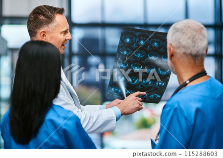 Doctor, team and x ray for consultation in hospital, analysis and check results of patient MRI. Employees, collaboration and CT scan or review assessment, healthcare and diagnosis study for anatomy Doctor, team and x ray for consultation in hospital, analysis and check results of patient MRI. Employees, collaboration and CT scan or review assessment, healthcare and diagnosis study for anatomy 115288603