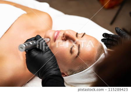 Microneedle RF lifting procedure. A cosmetologist performs a facial rejuvenation procedure on a woman. Hardware cosmetology. Microneedle RF lifting procedure. A cosmetologist performs a facial rejuvenation procedure on a woman. Hardware cosmetology. 115289423