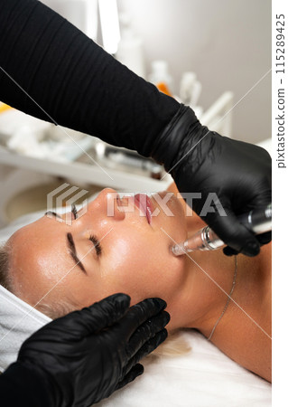 Microneedle RF lifting procedure. A cosmetologist performs a facial rejuvenation procedure on a woman. Hardware cosmetology. Microneedle RF lifting procedure. A cosmetologist performs a facial rejuvenation procedure on a woman. Hardware cosmetology. 115289425