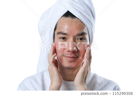 Smiling man taking care of skin for rapid recovery after laser resurfacing, applying moisturizer on his face Smiling man taking care of skin for rapid recovery after laser resurfacing, applying moisturizer on his face 115290308