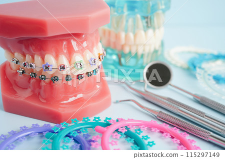 Orthodontic ligatures rings and ties, elastic rubber bands on orthodontic braces, model for dentist studying about dentistry. 115297149