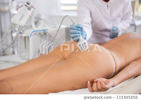 Aesthetician administering ice hammer therapy to tighten skin on female buttocks 115305850