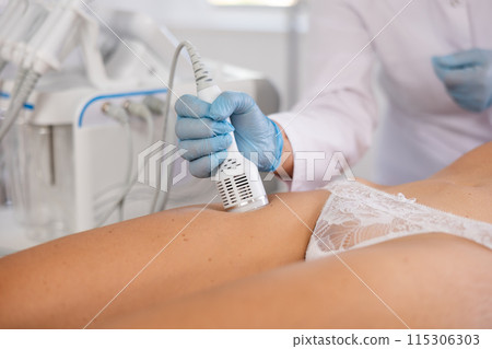 Aesthetician performing cryotherapy using cooling attachment on female client thighs Aesthetician performing cryotherapy using cooling attachment on female client thighs 115306303