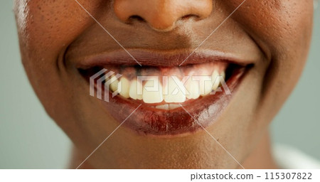 Person, african and closeup with teeth, smile and dental care and oral hygiene or health. Mouth, zoom and portrait with wellness, medical and happy with dentist results and whitening for beauty 115307822