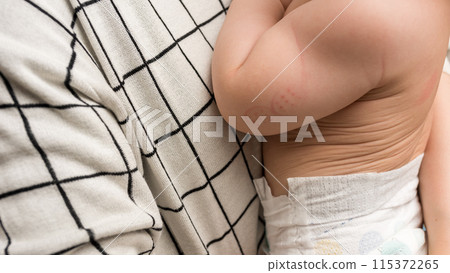 預防接種 115372265