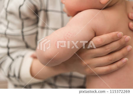 Vaccination 115372269