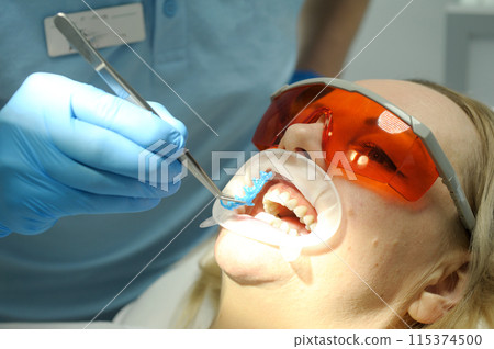 removes hardened liquid rubber dam to isolate gums active substance of teeth whitening glasses on woman protecting from photopolymer whitening lamp by American device frequency desire to be beautiful 115374500